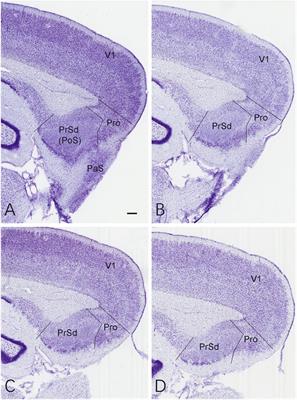 The effects of bilateral prostriata lesions on spatial learning and memory in the rat